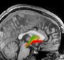 Neuroscience of Need: Understanding the Addicted Mind